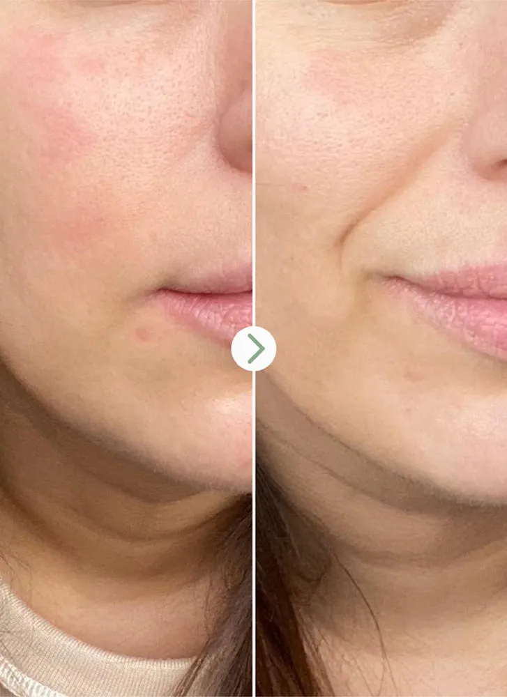 Pai Skincare Partners in Calm Cleanser & Moisturizer Set